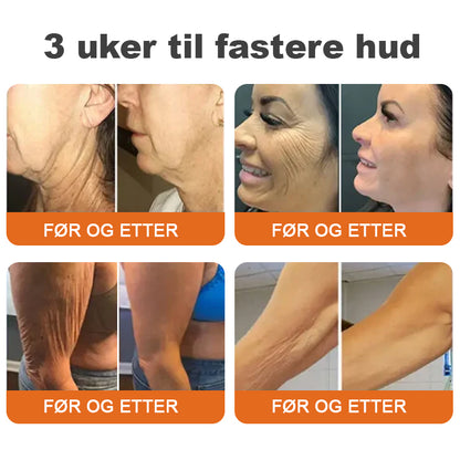 🌿Laget og sendt fra Norge✨Flysmus™ Botox Biegift Oppstrammende Serumstift👩‍🔬SISTE DAG – 70% RABATT
