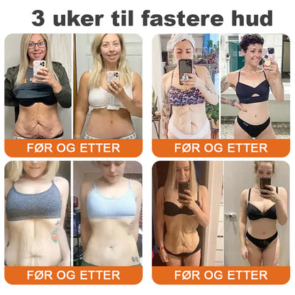 🌿Laget og sendt fra Norge✨Flysmus™ Botox Biegift Oppstrammende Serumstift👩‍🔬SISTE DAG – 70% RABATT