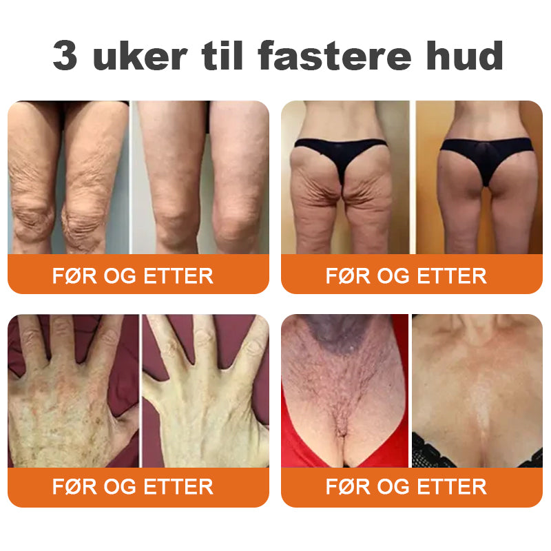 🌿Laget og sendt fra Norge✨Flysmus™ Botox Biegift Oppstrammende Serumstift👩‍🔬SISTE DAG – 70% RABATT