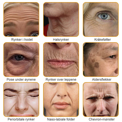 🌸🌿✨Laget og sendt fra Norge ✅ Furzero™ Botox Bee Venom Rynkefjerningskrem - Siste dag kampanje 70 % AVSLAG