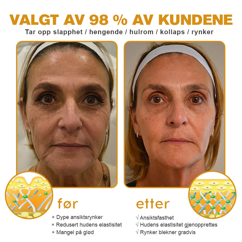 🌸🌿✨Laget og sendt fra Norge ✅ Furzero™ Botox Bee Venom Rynkefjerningskrem - Siste dag kampanje 70 % AVSLAG