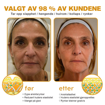 🌸🌿✨Laget og sendt fra Norge ✅ Furzero™ Botox Bee Venom Rynkefjerningskrem - Siste dag kampanje 70 % AVSLAG