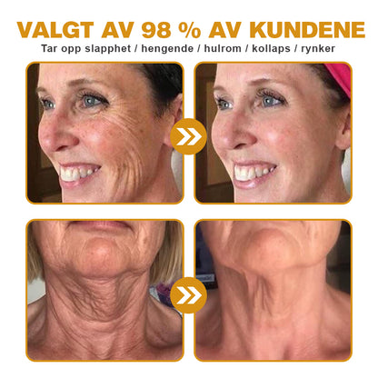 🌸🌿✨Laget og sendt fra Norge ✅ Furzero™ Botox Bee Venom Rynkefjerningskrem - Siste dag kampanje 70 % AVSLAG