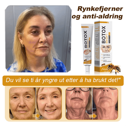 🌸🌿✨Laget og sendt fra Norge ✅ Furzero™ Botox Bee Venom Rynkefjerningskrem - Siste dag kampanje 70 % AVSLAG